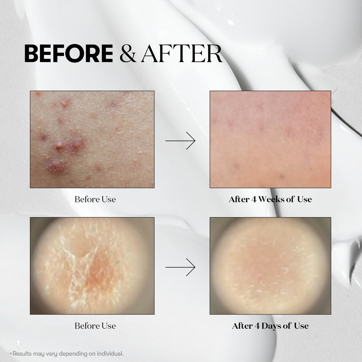 VT Cosmetics - Reedle Shot 100 - 50ml